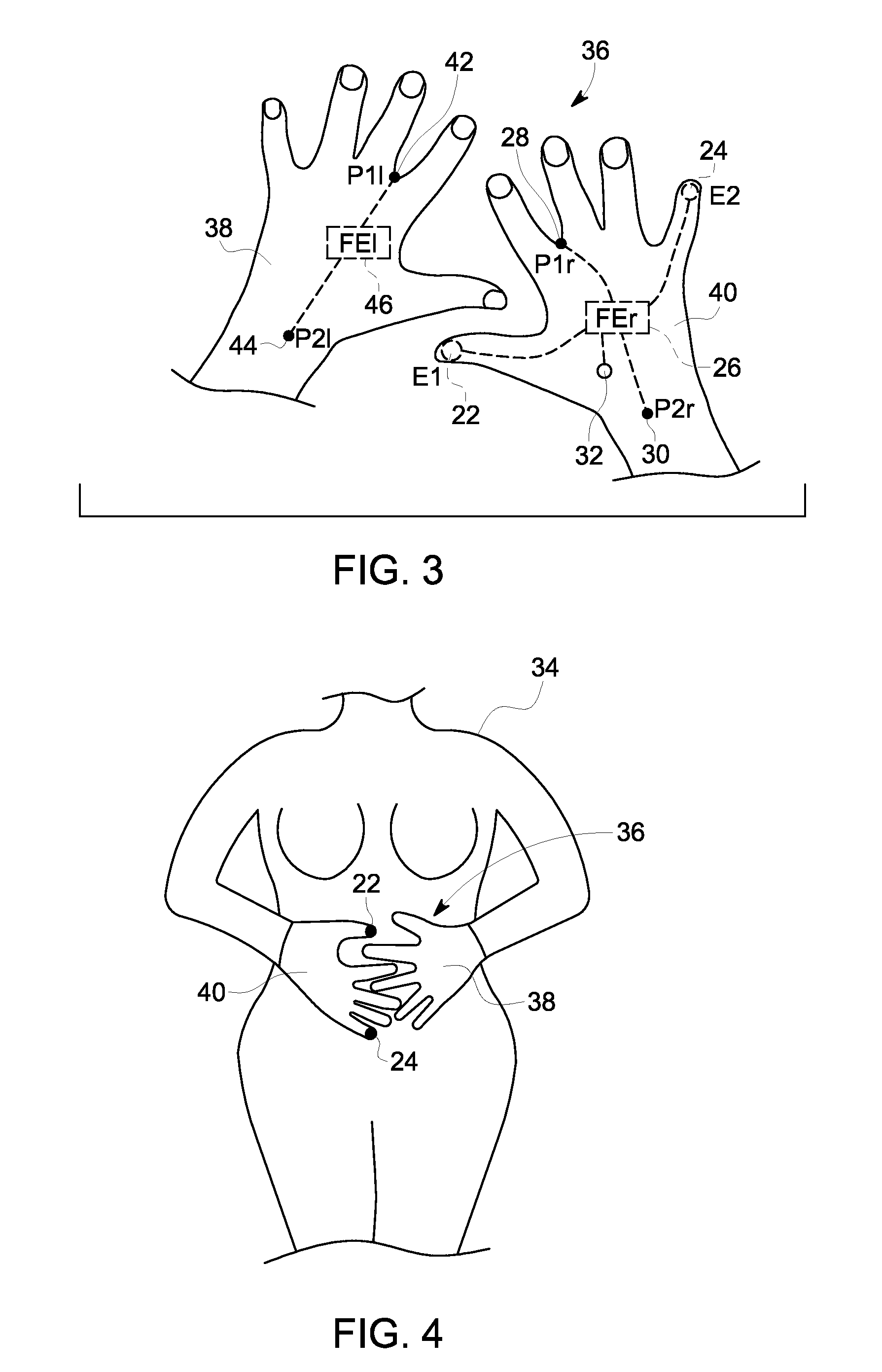Fetal monitoring device and method