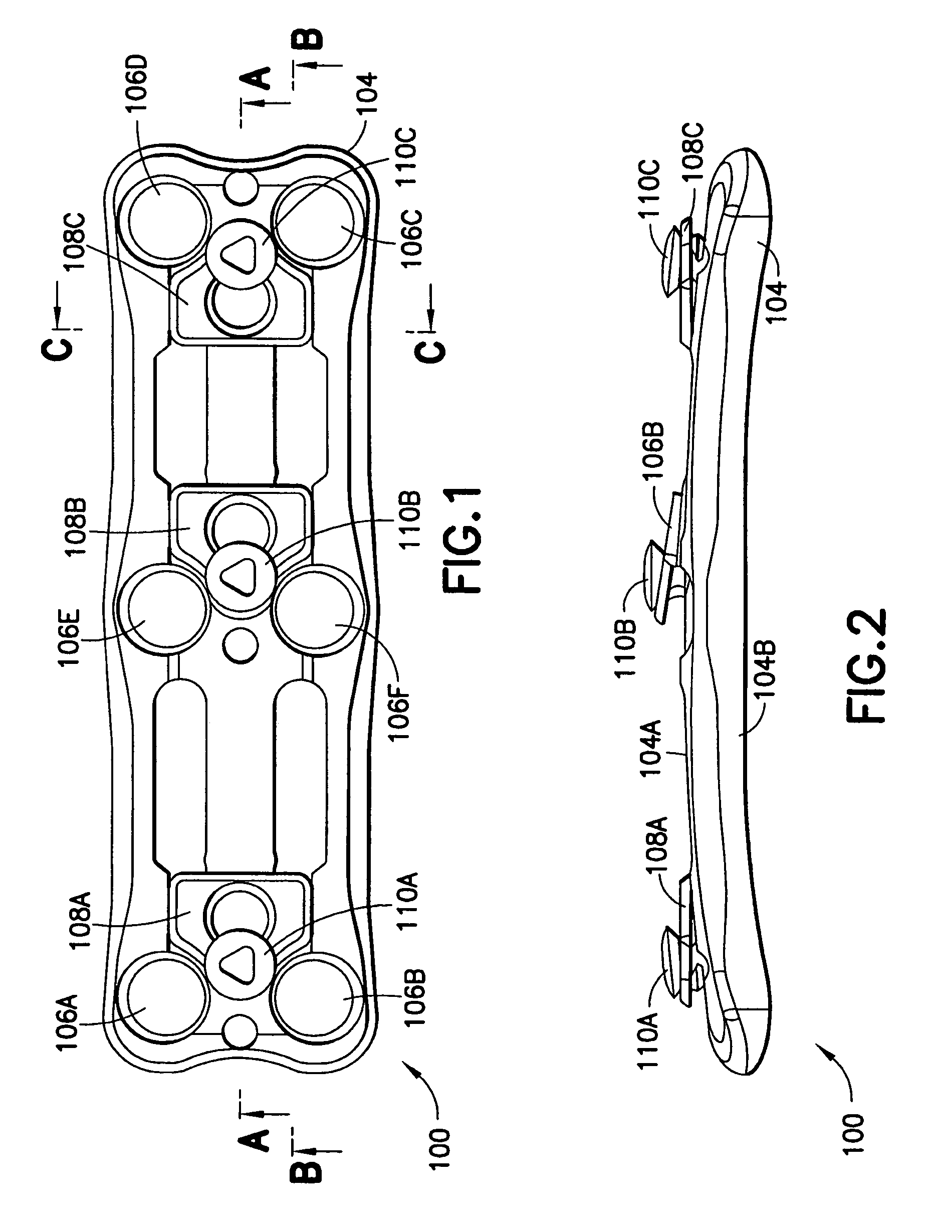 Anterior cervical plating system