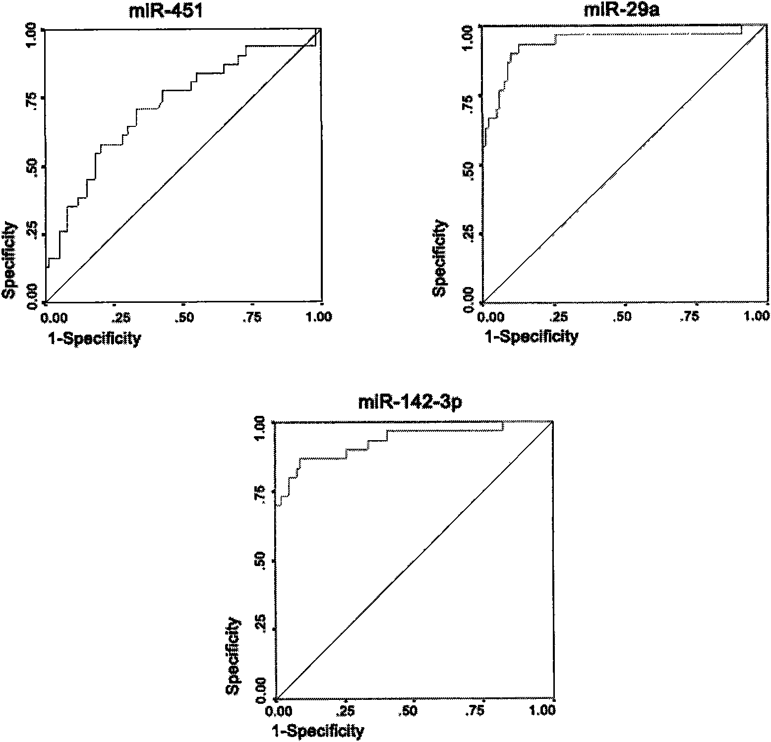 Application of three microRNAs in diagnosis and treatment of human acute myeloid leukemia