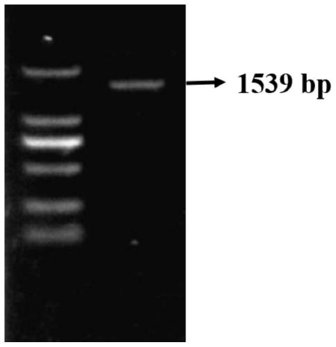 Endoglucanase, its coding gene cel5a-h15 and its application