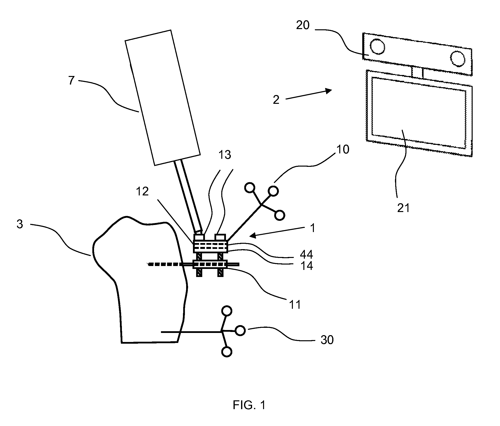 Device for controlled adjustment of a surgical positioning unit