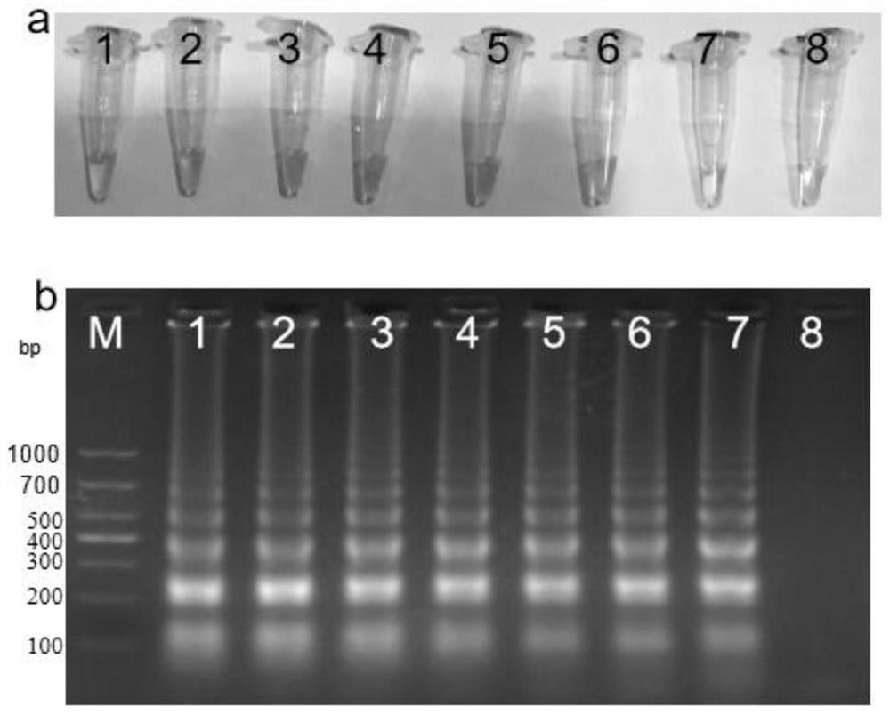 Streptococcus agalactiae amplification primer group, application and detection method of streptococcus agalactiae