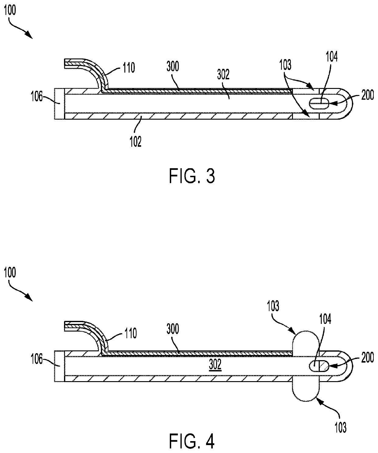 Catheter systems and methods