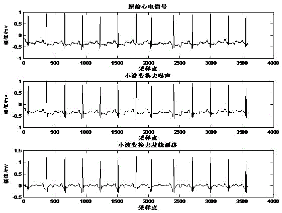 Real-time electrocardiogramclassification method based on random projection