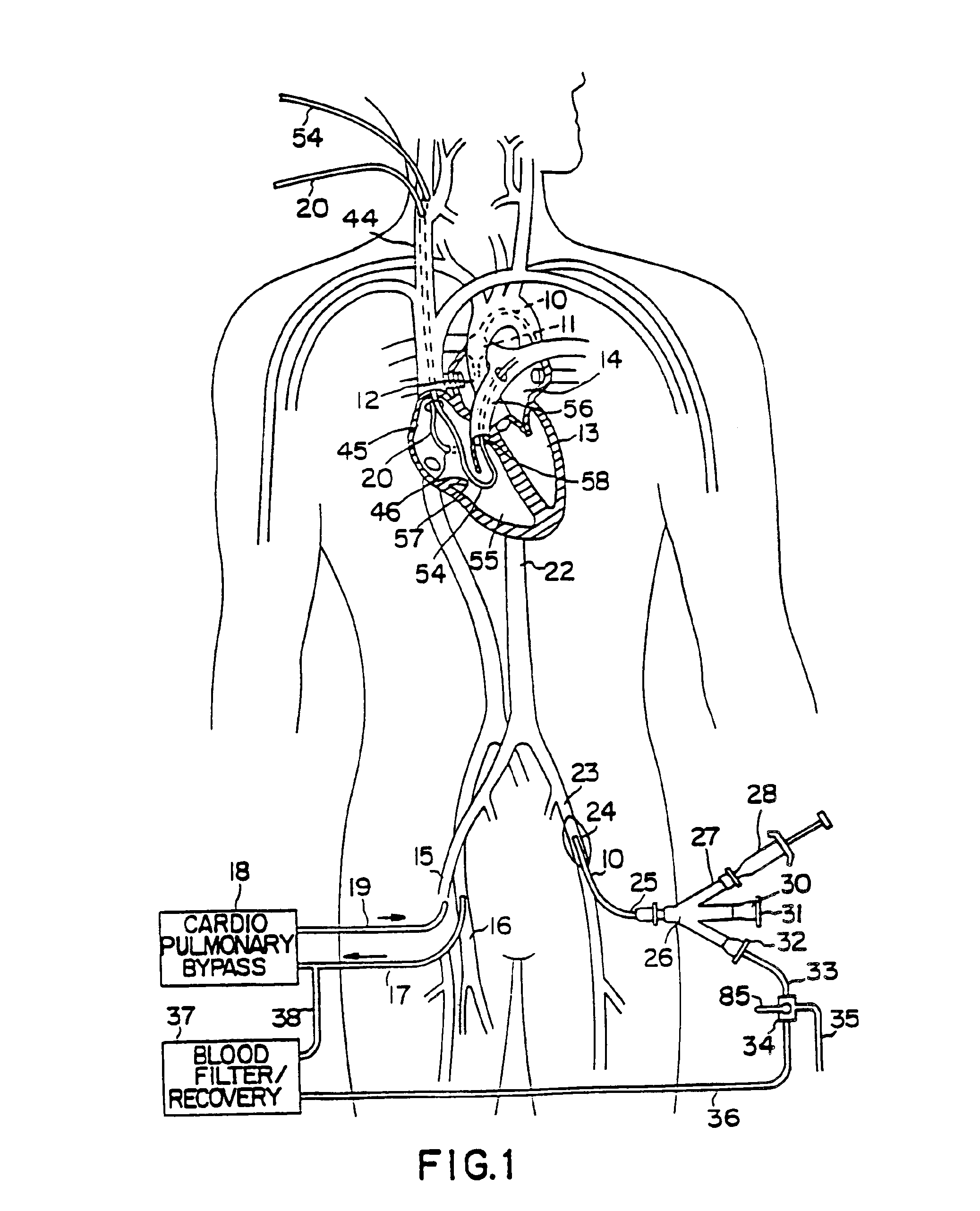 System for cardiac procedures