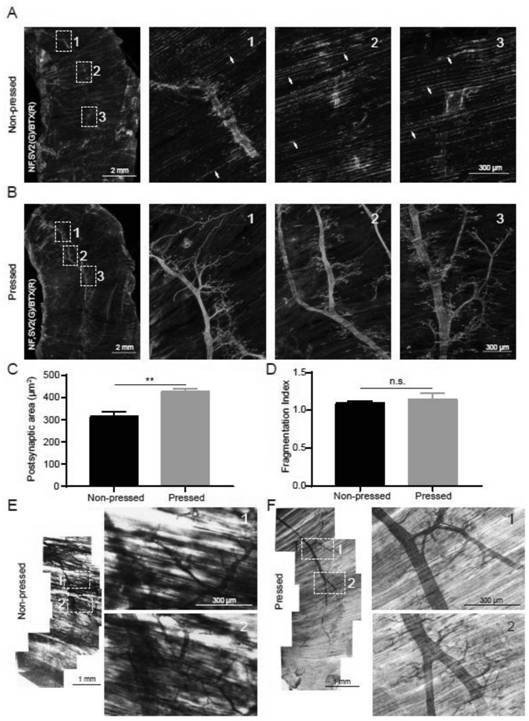 A Pretreatment Method for Whole-mount Immunostaining of Adult Diaphragm