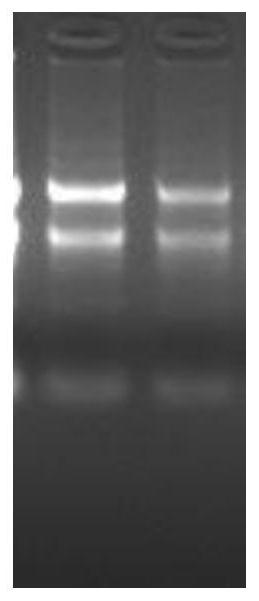 Construction and application of an anti-sclerotinia gene gmgst1 and gmgst1 transgenic plant