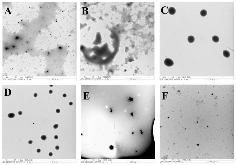 A kind of amino acid-chitosan nano drug loading system, its preparation method and application