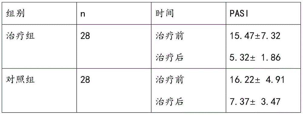 Drug for treating blood-heat psoriasis and preparation method thereof