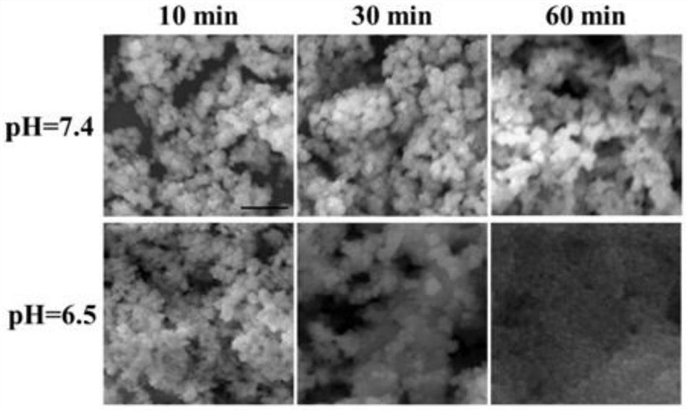Preparation method of composite nanoparticles for increasing active oxygen content in tumor cells