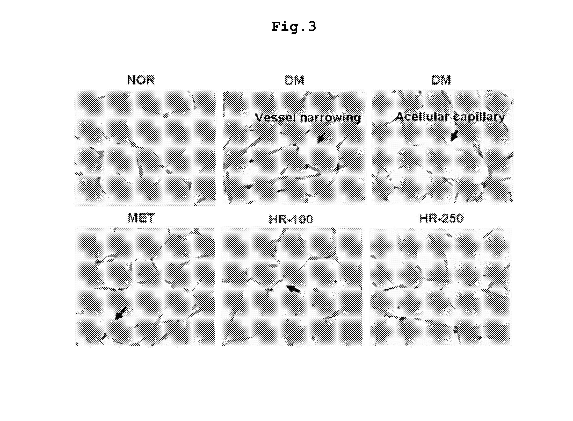 Pharmaceutical composition for preventing and treating complications of  diabetes containing a traditional oriental medicine extract or a fraction thereof as an active ingredient