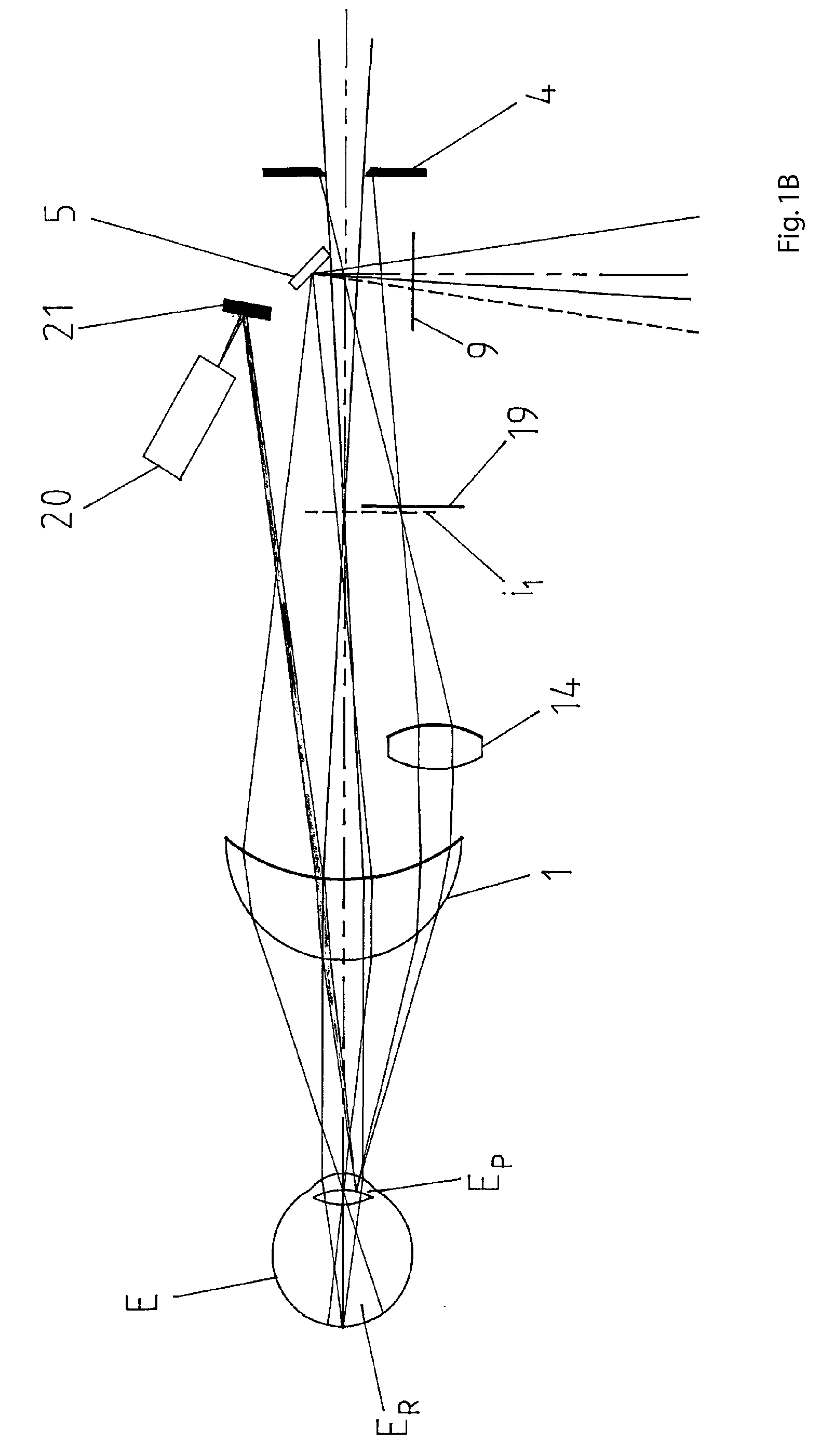 System to facilitate alignment and focussing of a fundus camera