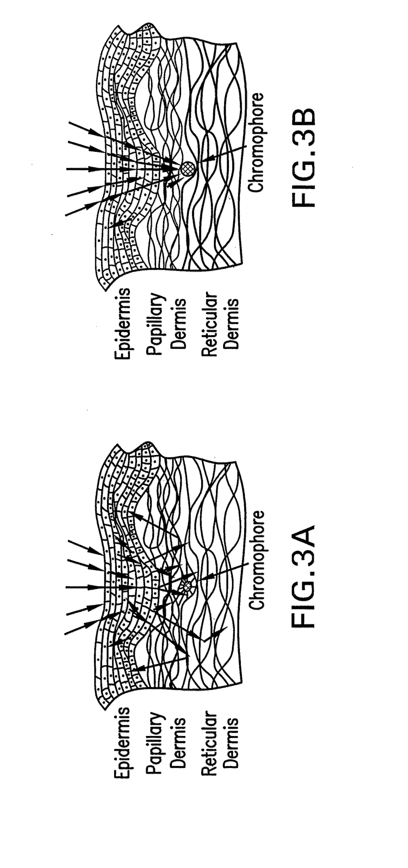 System, devices, and methods for optically clearing tissue