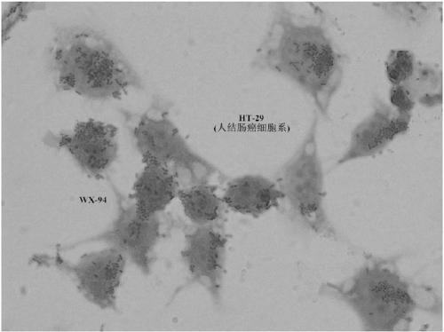 Lactobacillus reuteri and application thereof