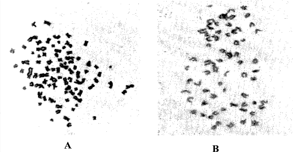 A human pancreatic cancer cell line resistant to gemcitabine and its application