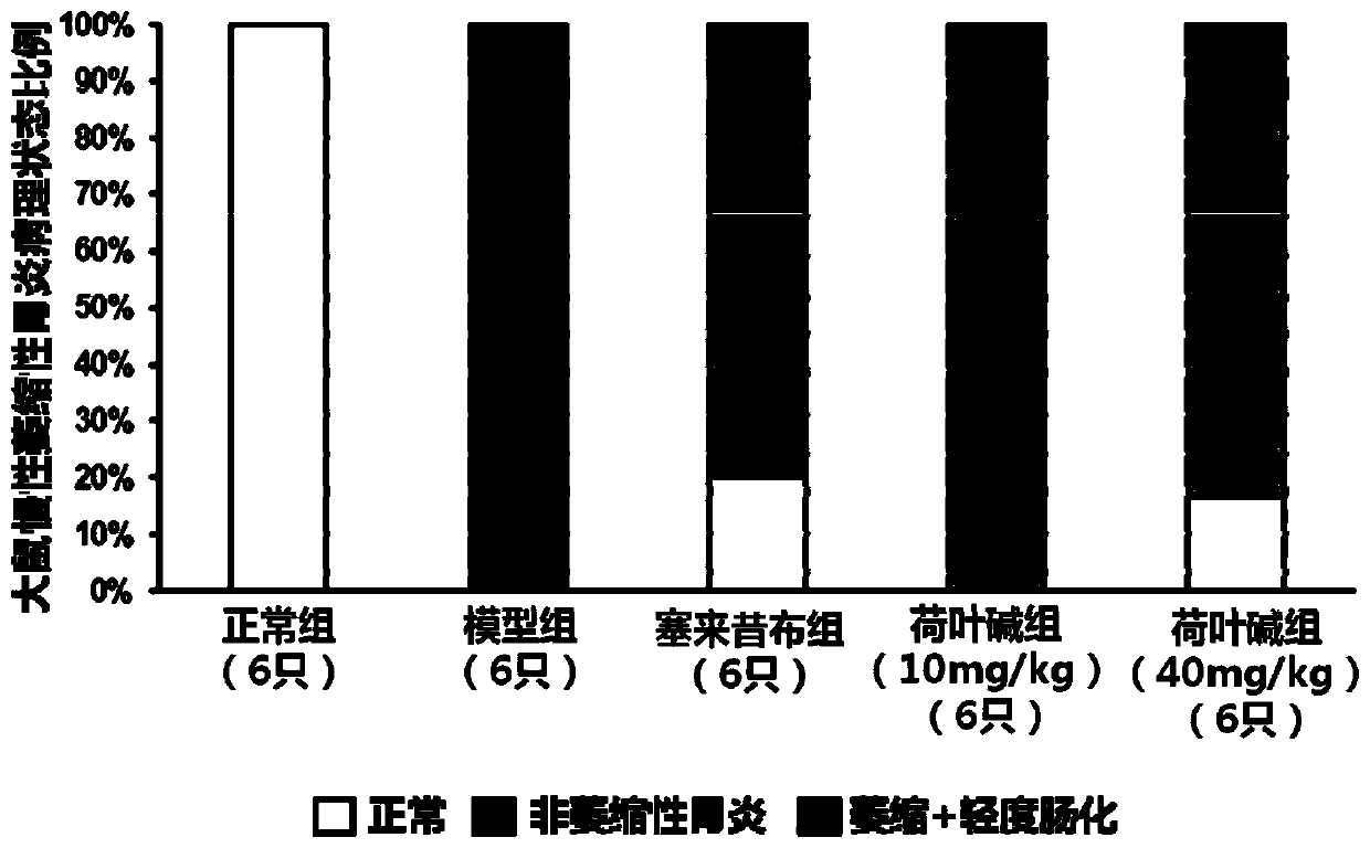 Application of nuciferine and lotus leaf extract in preparation of drug for treating atrophic gastritis and/or blocking gastritis cancer conversion