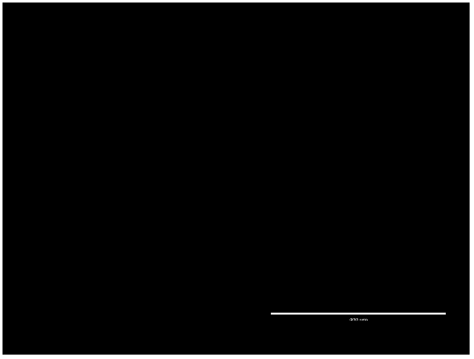 Fibrinogen compound and application thereof