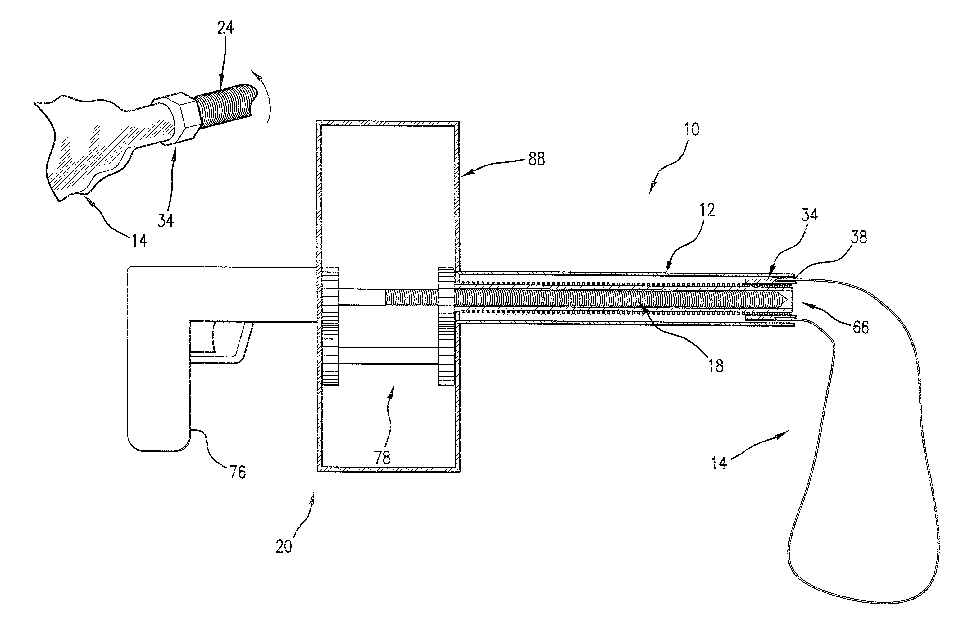 Medical device and method for human tissue and foreign body extraction