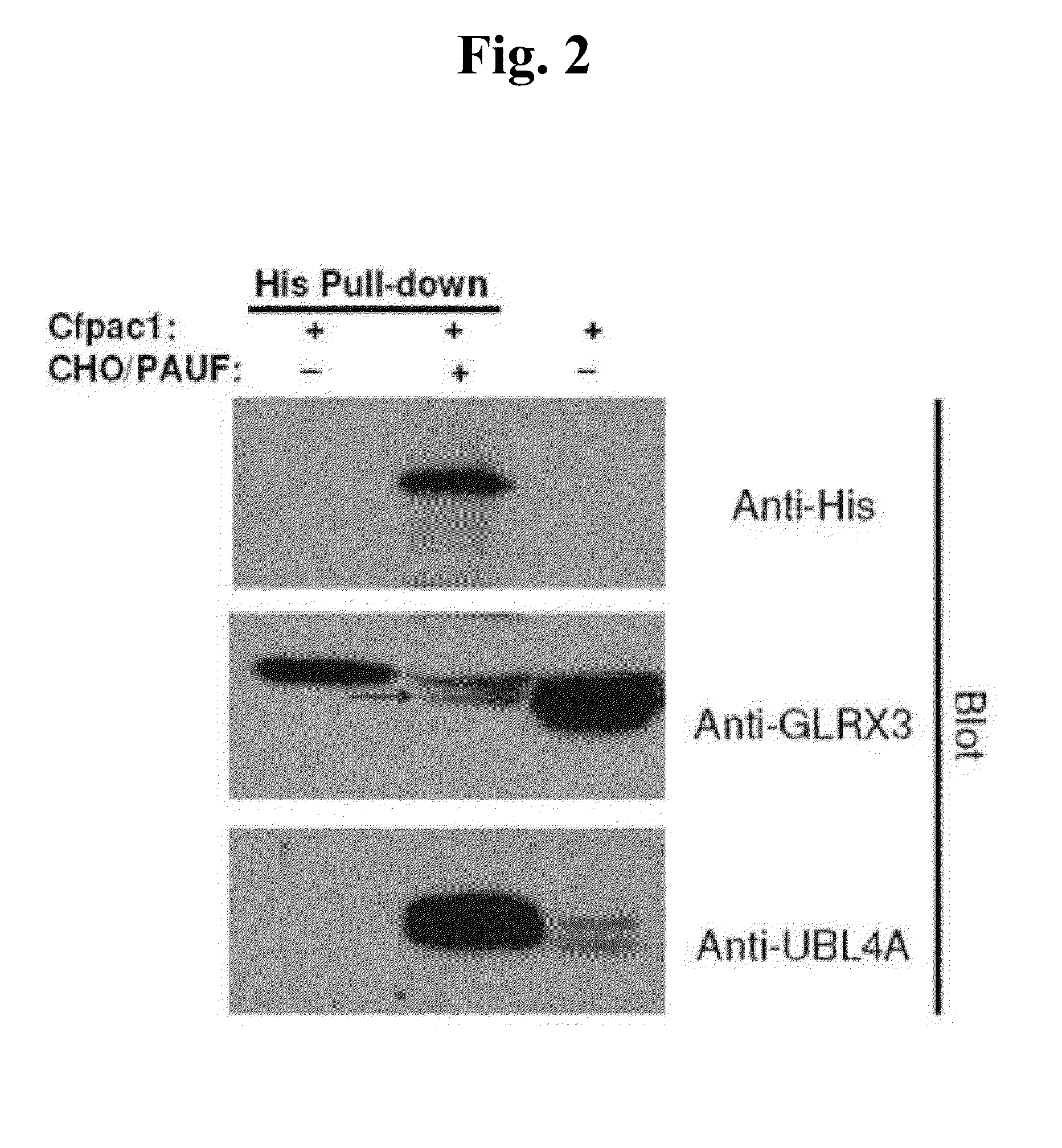 Method for screening for a cancer treatment agent using the interaction between pauf and a binding partner thereof