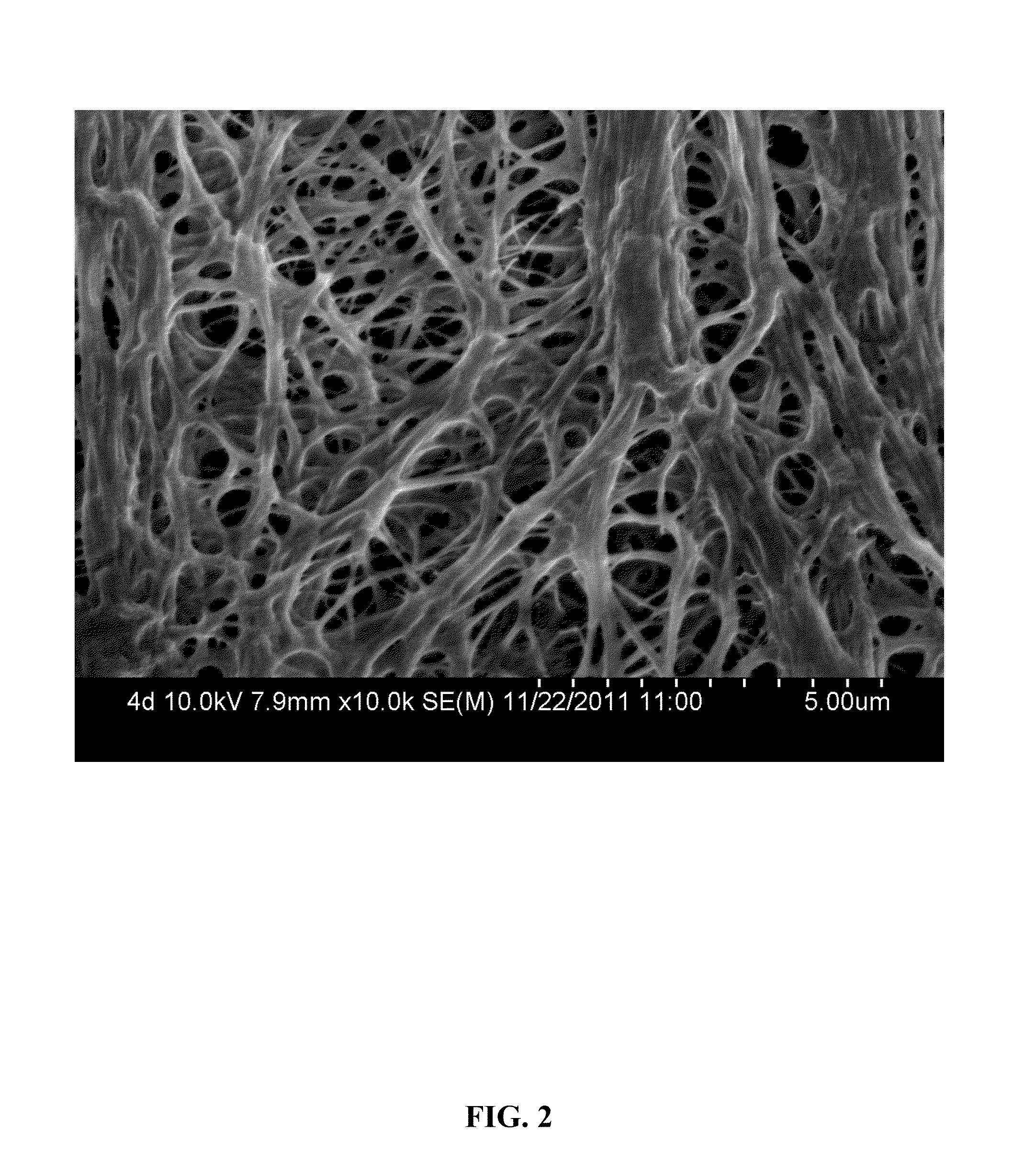 Microporous membrane of polyethylene-based composite material and preparation method thereof