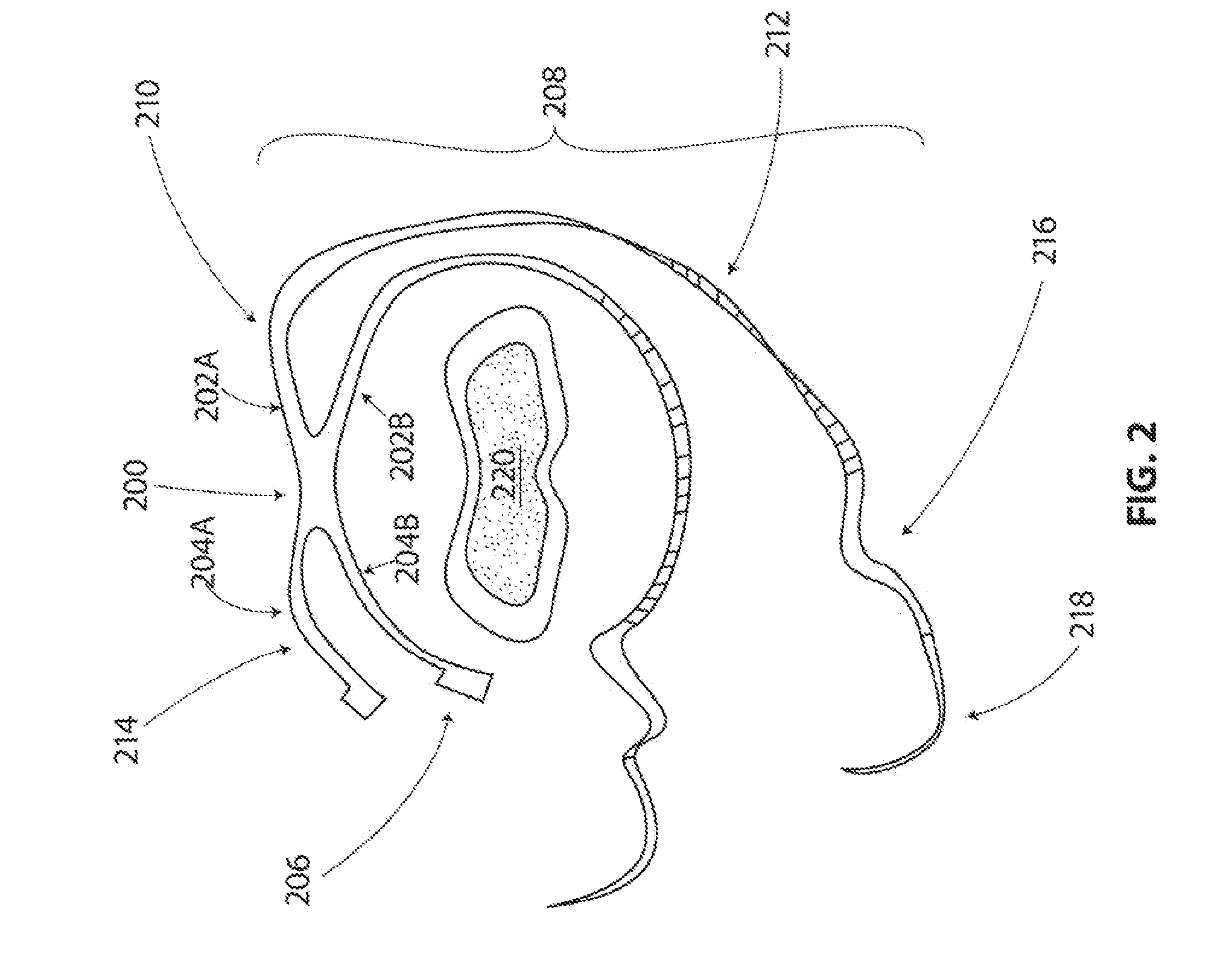 Systems and methods for sternum repair