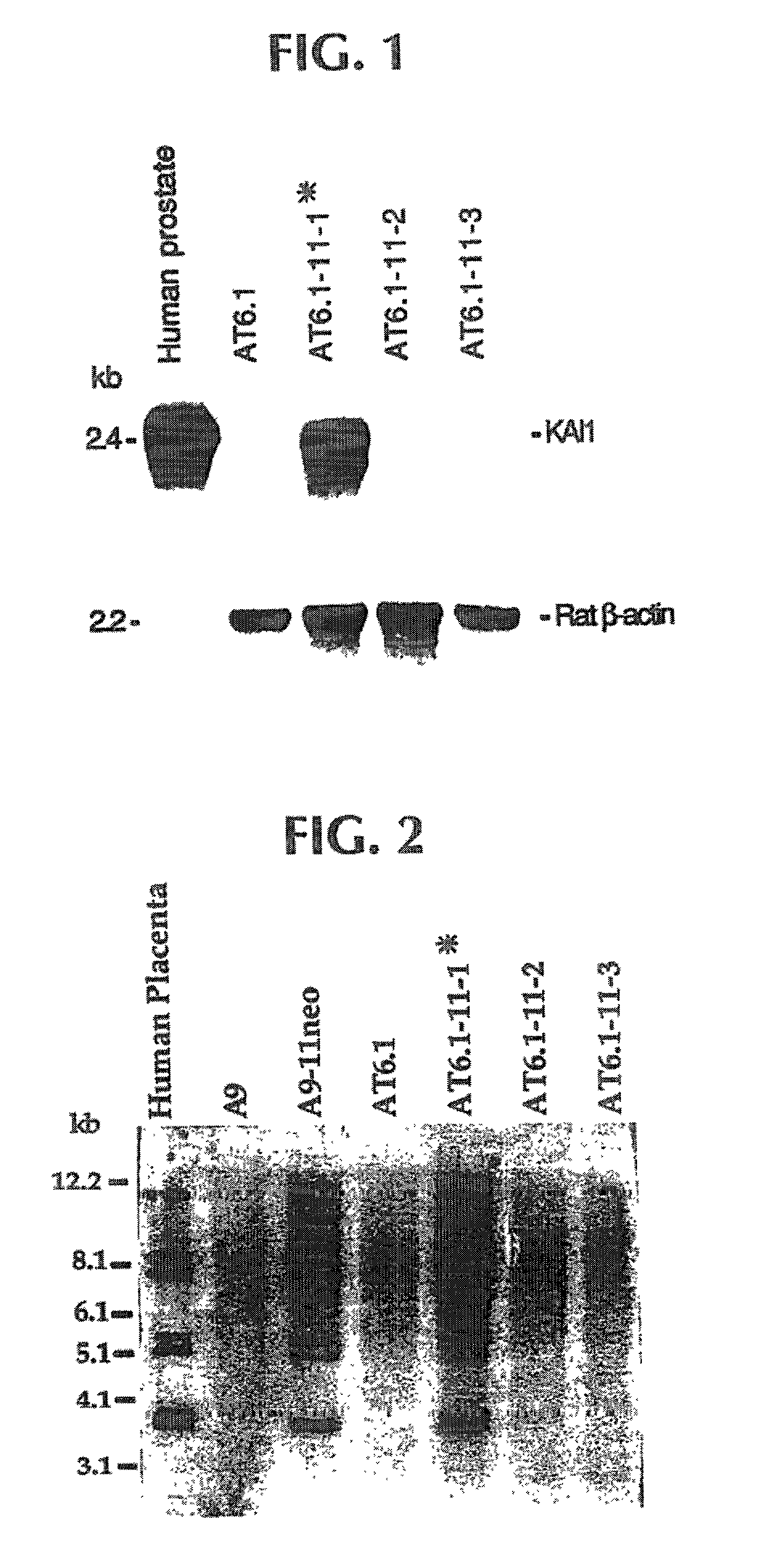 Diagnostic methods and gene therapy using reagents derived from the human metastasis suppressor gene KAI1