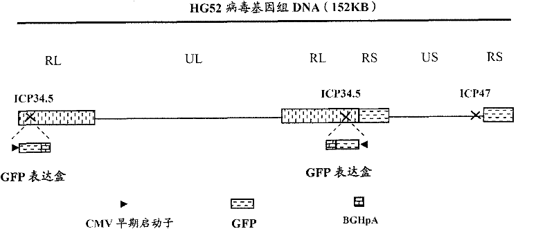 Recombined II-type herpes simplex virus, preparation method and application and tumour diagnostic reagent kit