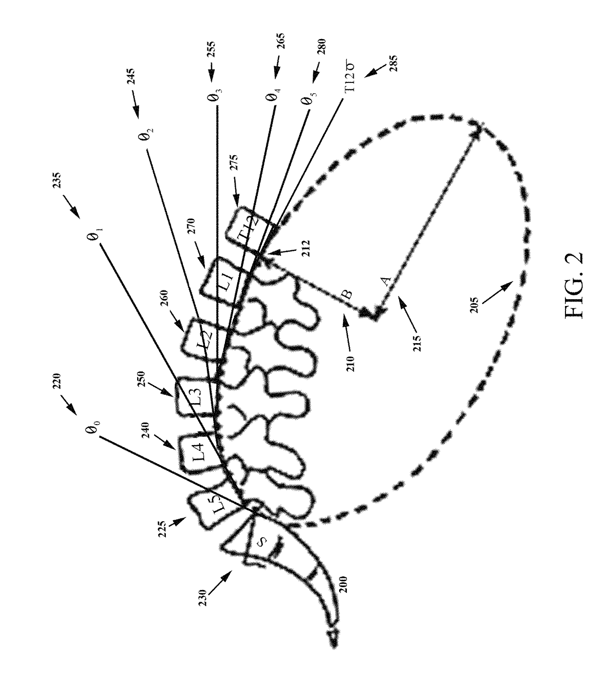 System for dynamically adjusting treatment angle under tension to accommodate variations in spinal morphology