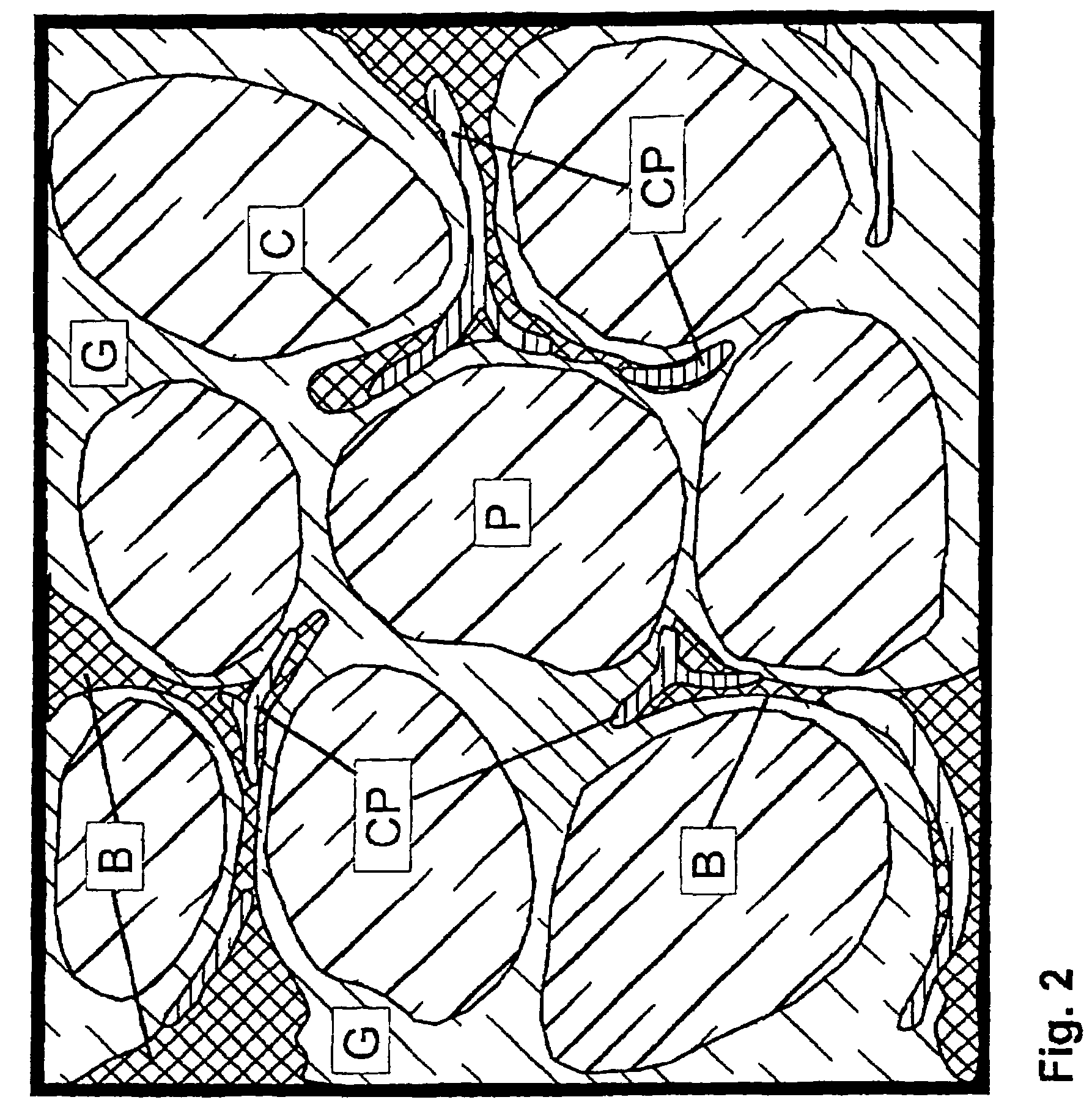 Method for manufacturing particles for use in forming a resorbable implant for stimulating bone growth