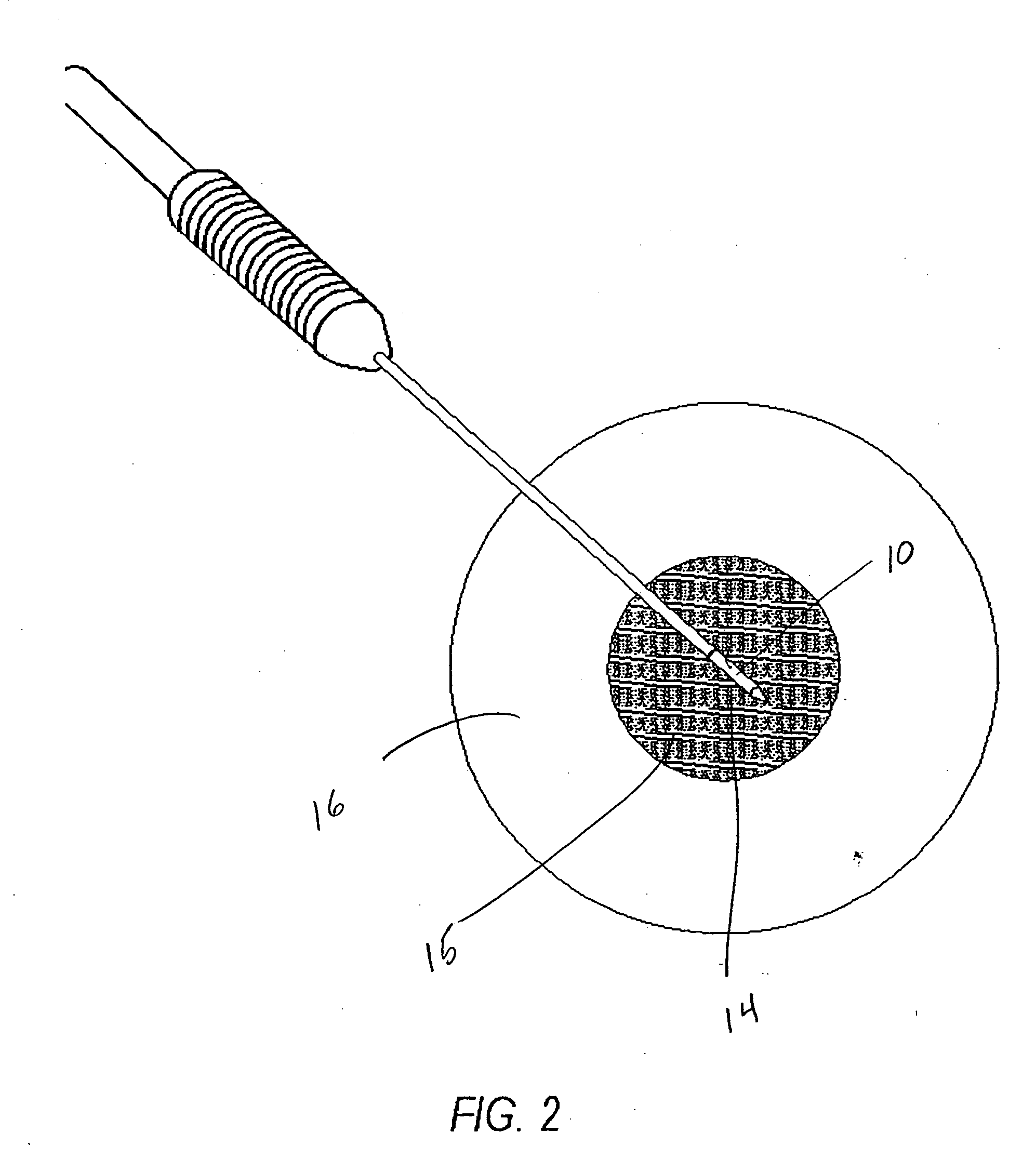 Cell necrosis apparatus with cooled microwave antenna