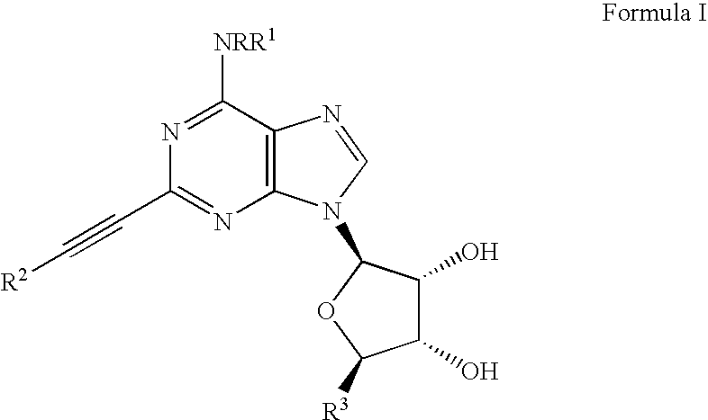 Adenosine A3 receptor agonists