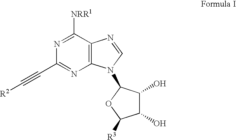Adenosine A3 receptor agonists