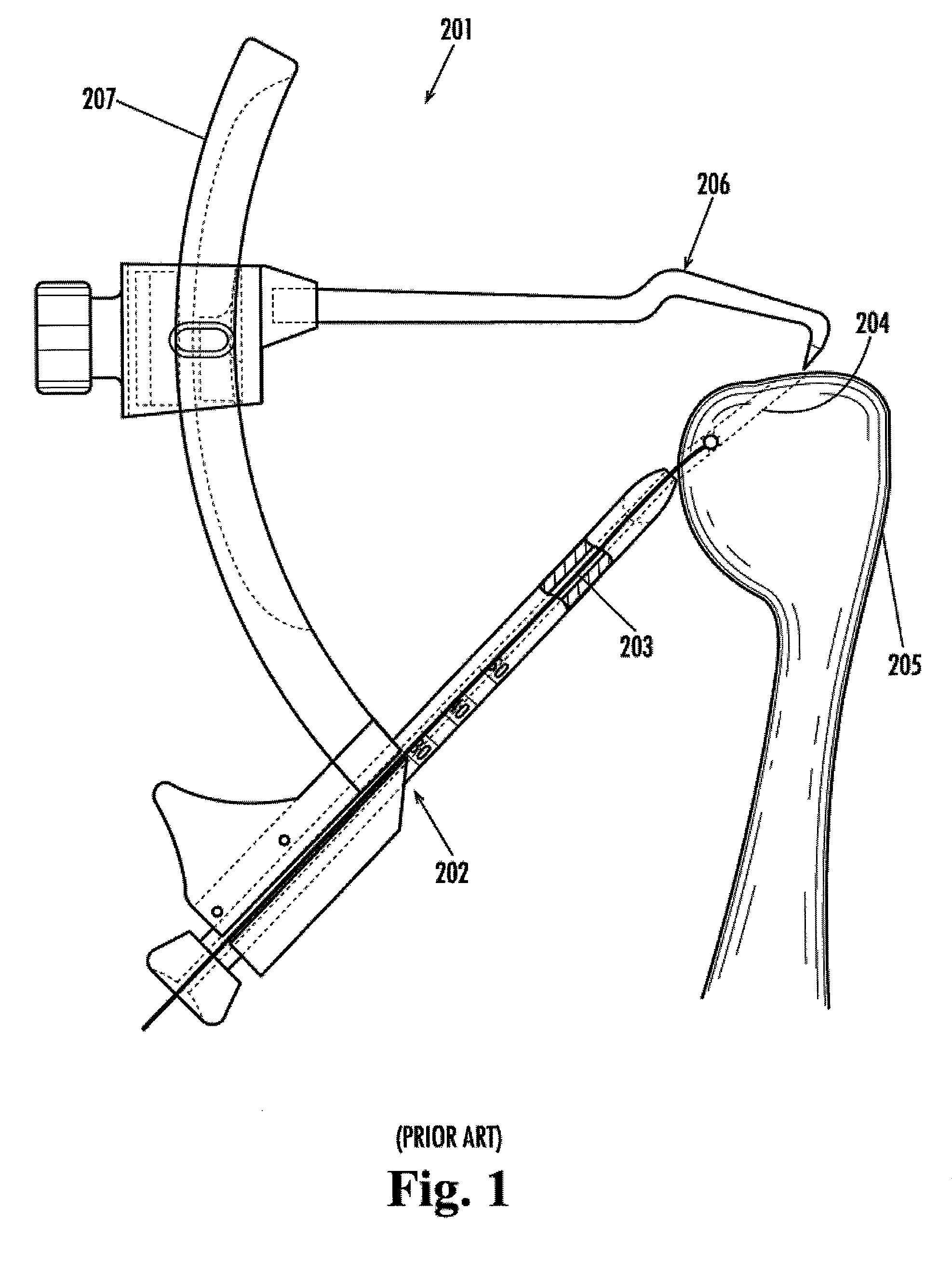 Device for the intraosteal seizing of sutures
