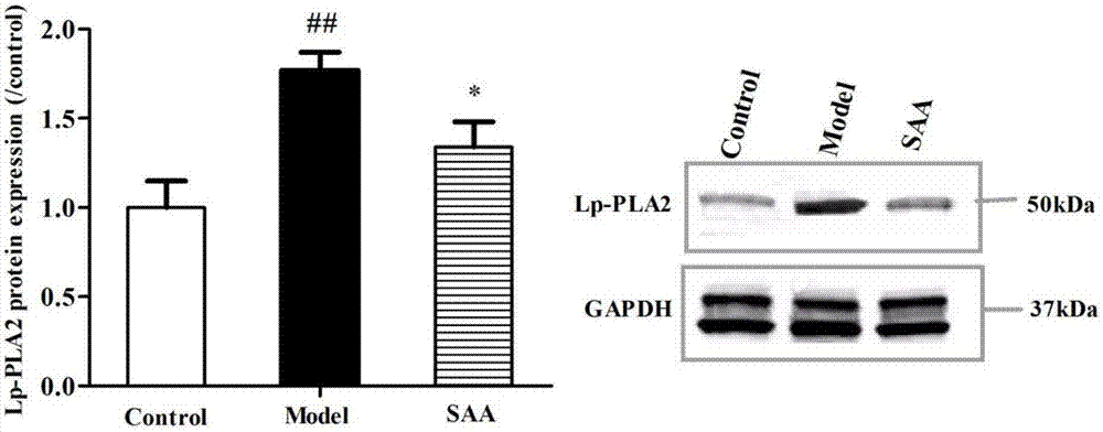 New application of salvianolic acid A as lipoprotein-associated phospholipase A2 inhibitor