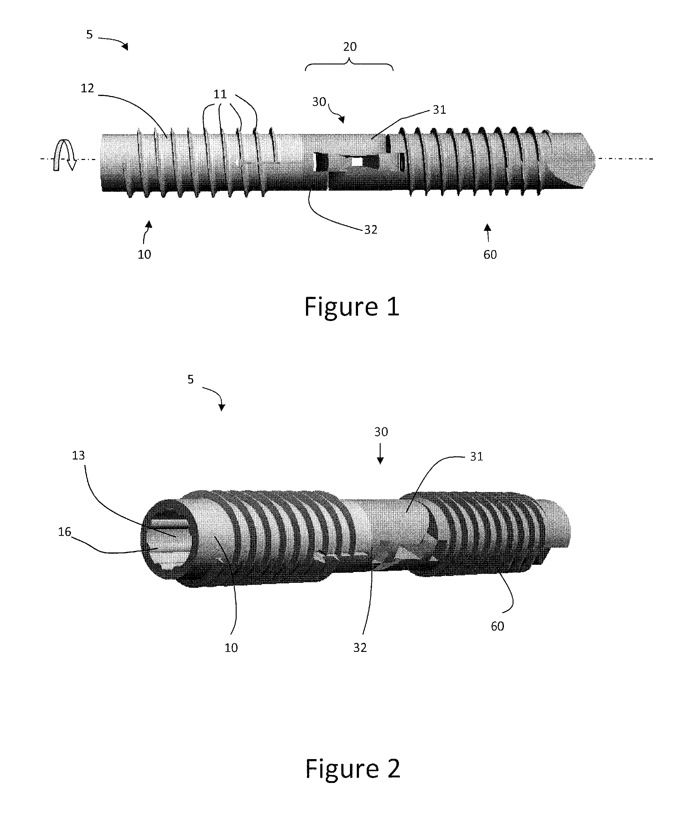 Distal interphalangeal fusion method and device