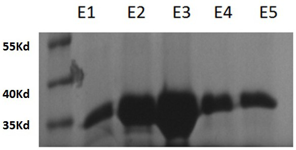 Fructose detection method based on fructokinase reaction system