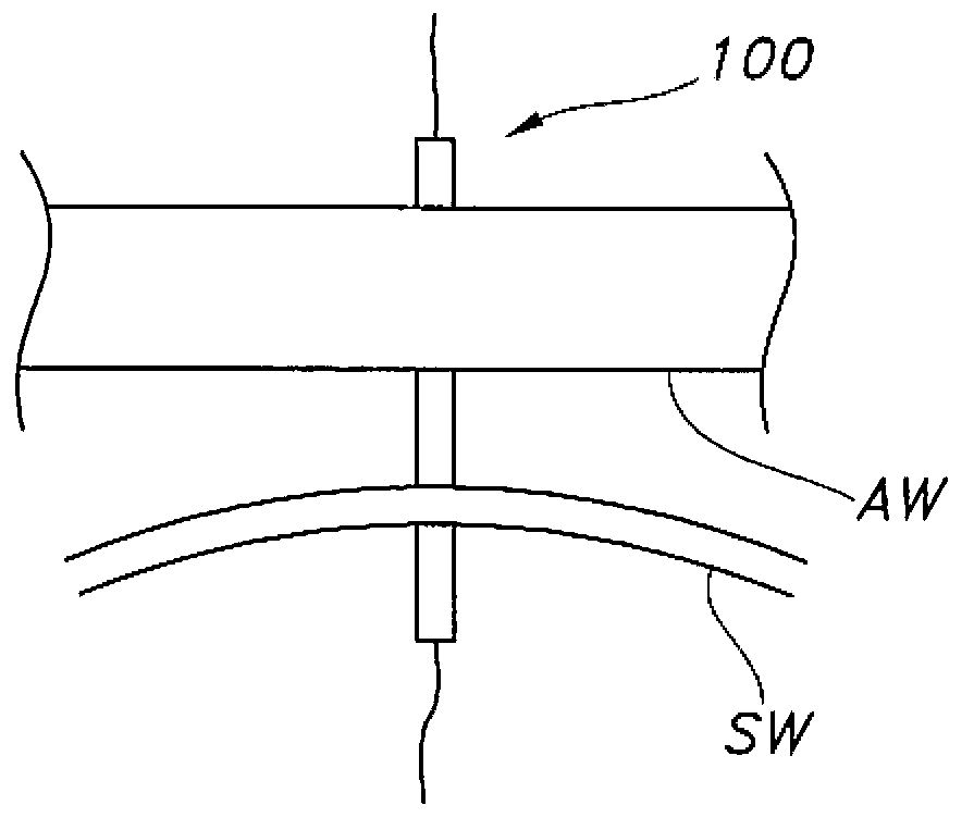 Multi-balloon dilation device for placing catheter tubes