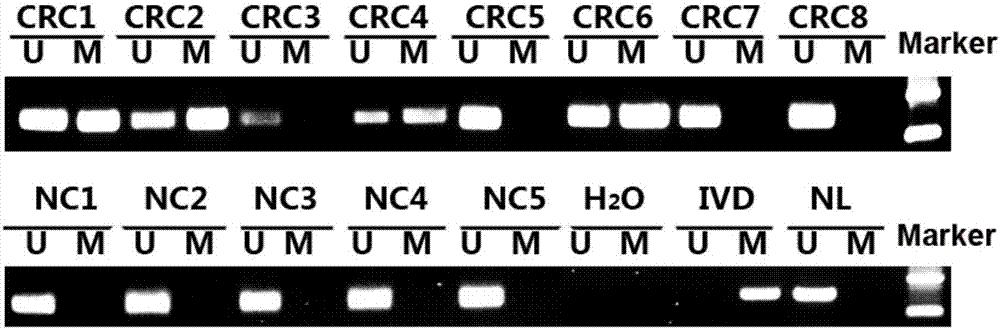 Primer pair for detecting DNA methylation state of promoter region of cell RAI2 gene and kit