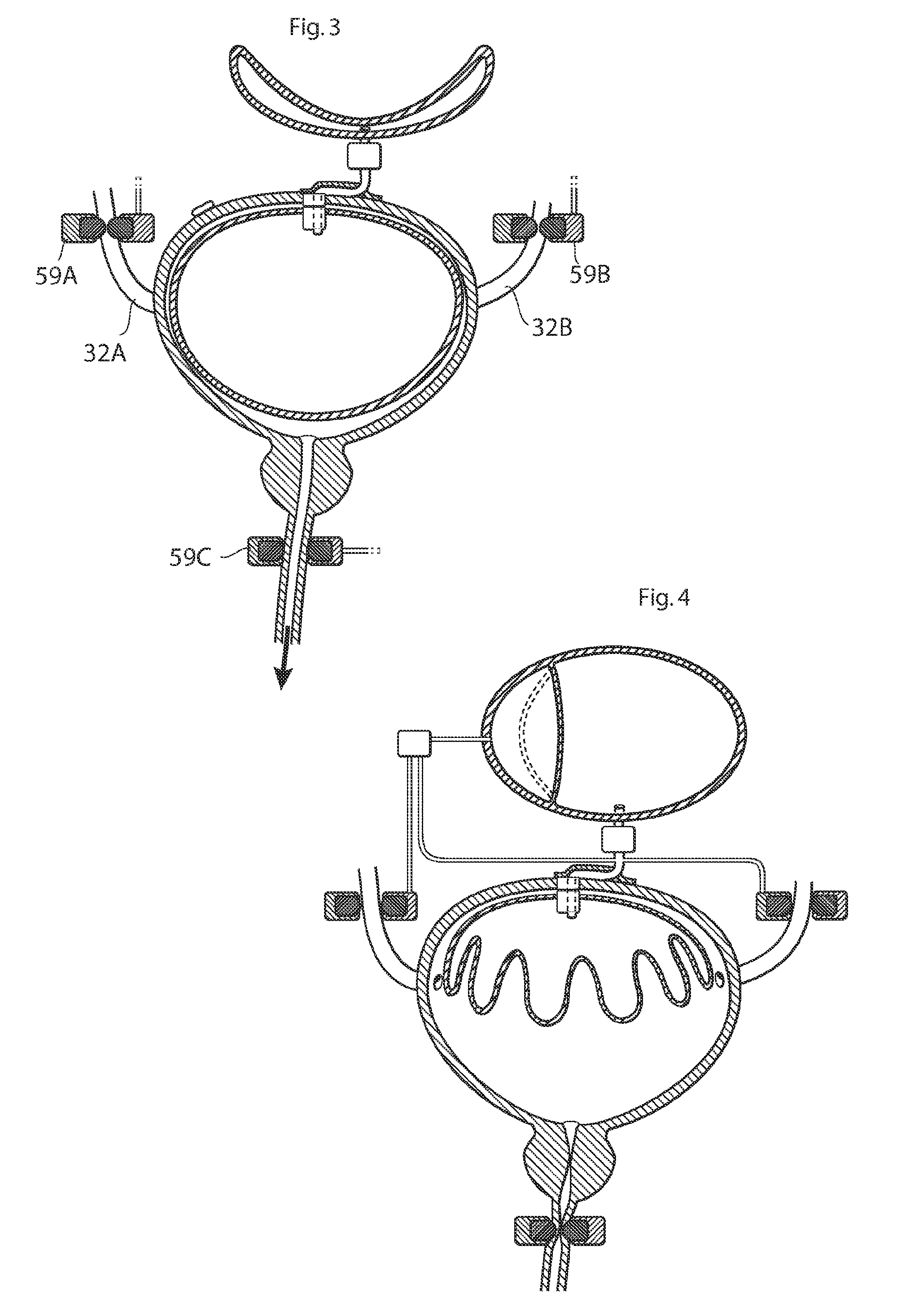 Implantable device for internal urinary control