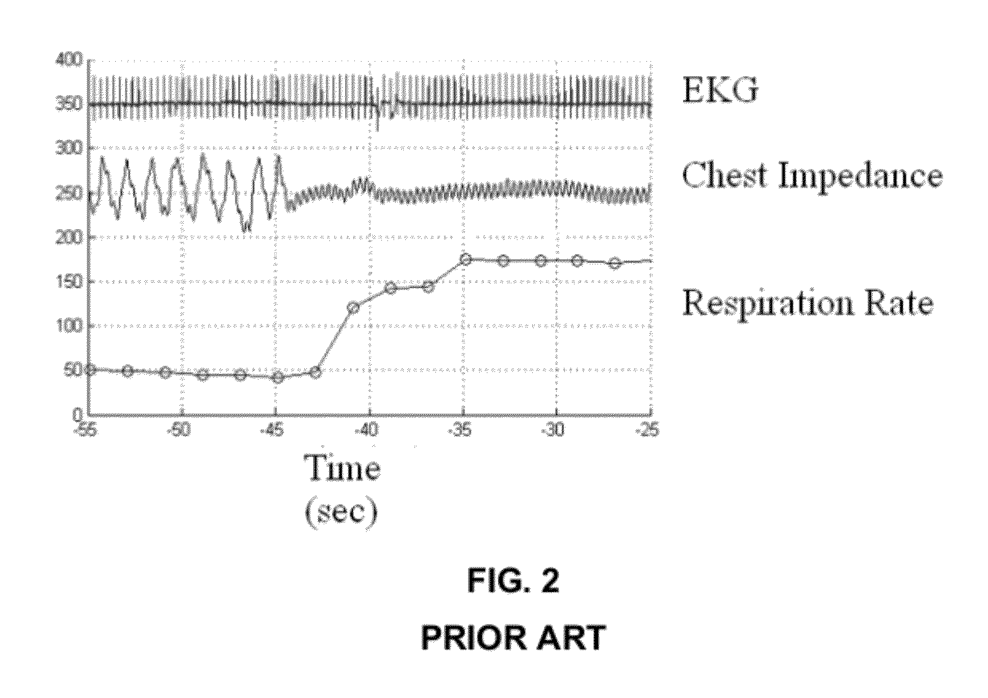Method and system for detecting apnea