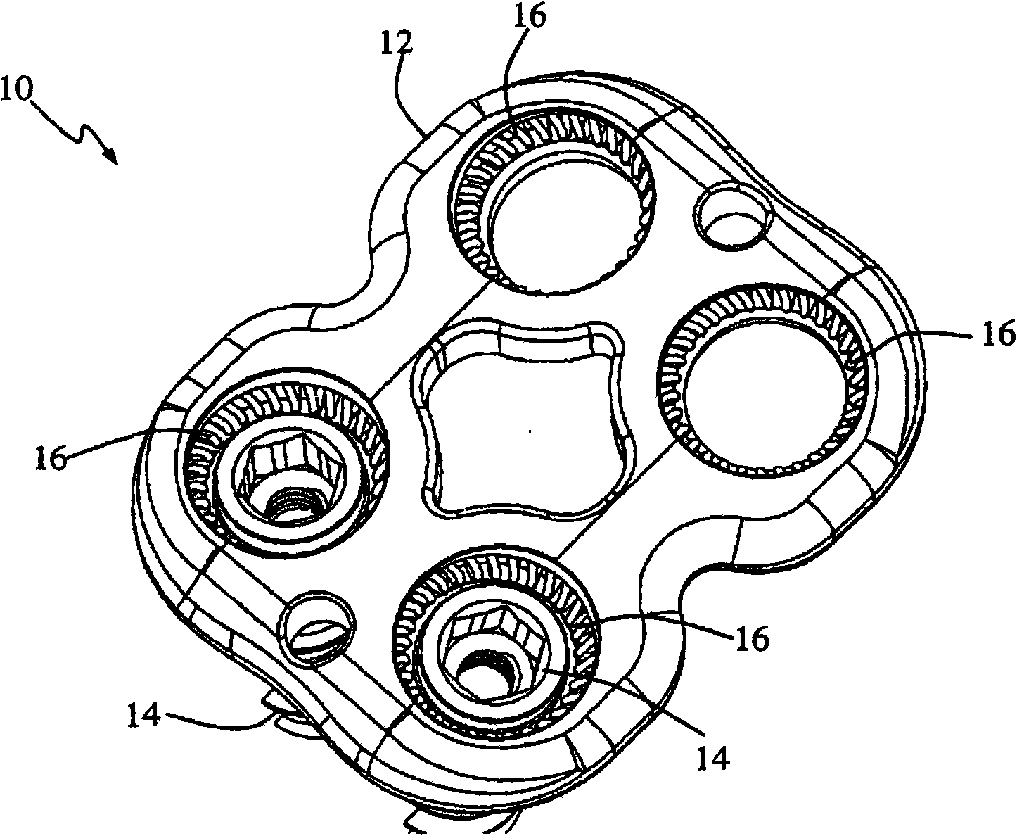 Surgical fixation system and related methods