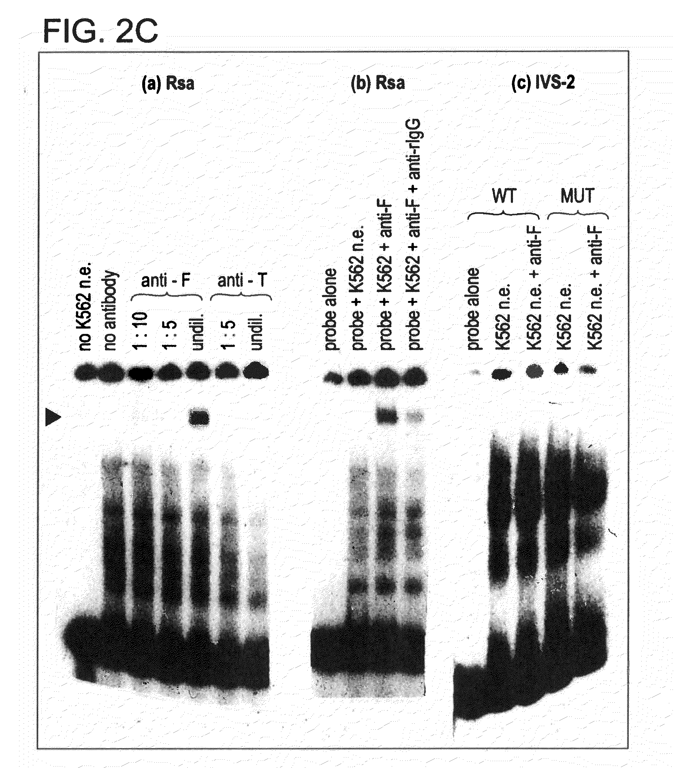 Method for Regulating Production of Hemoglobin Beta Chains