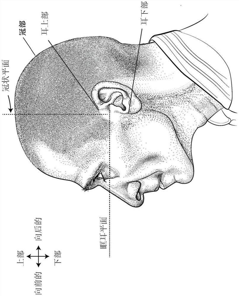 Positioning, stabilizing, and interface