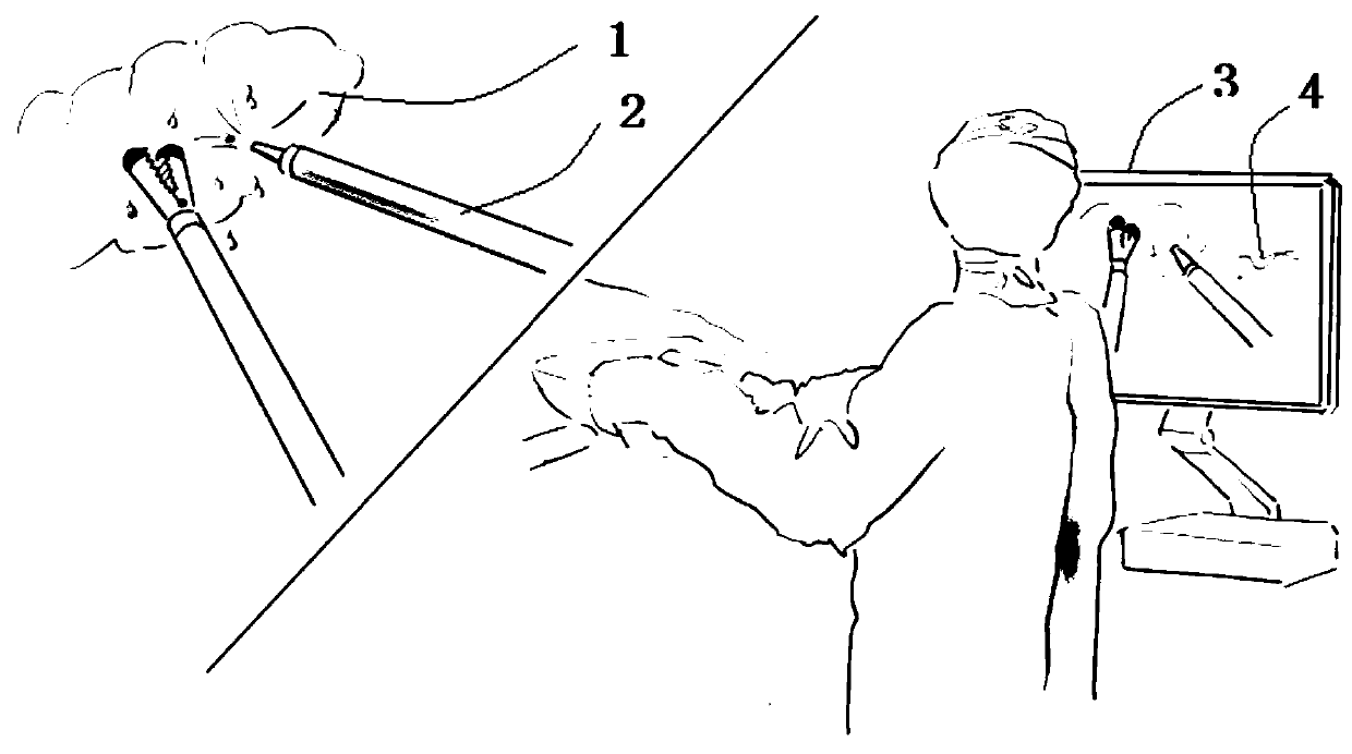 Tissue detection device in minimally invasive surgery