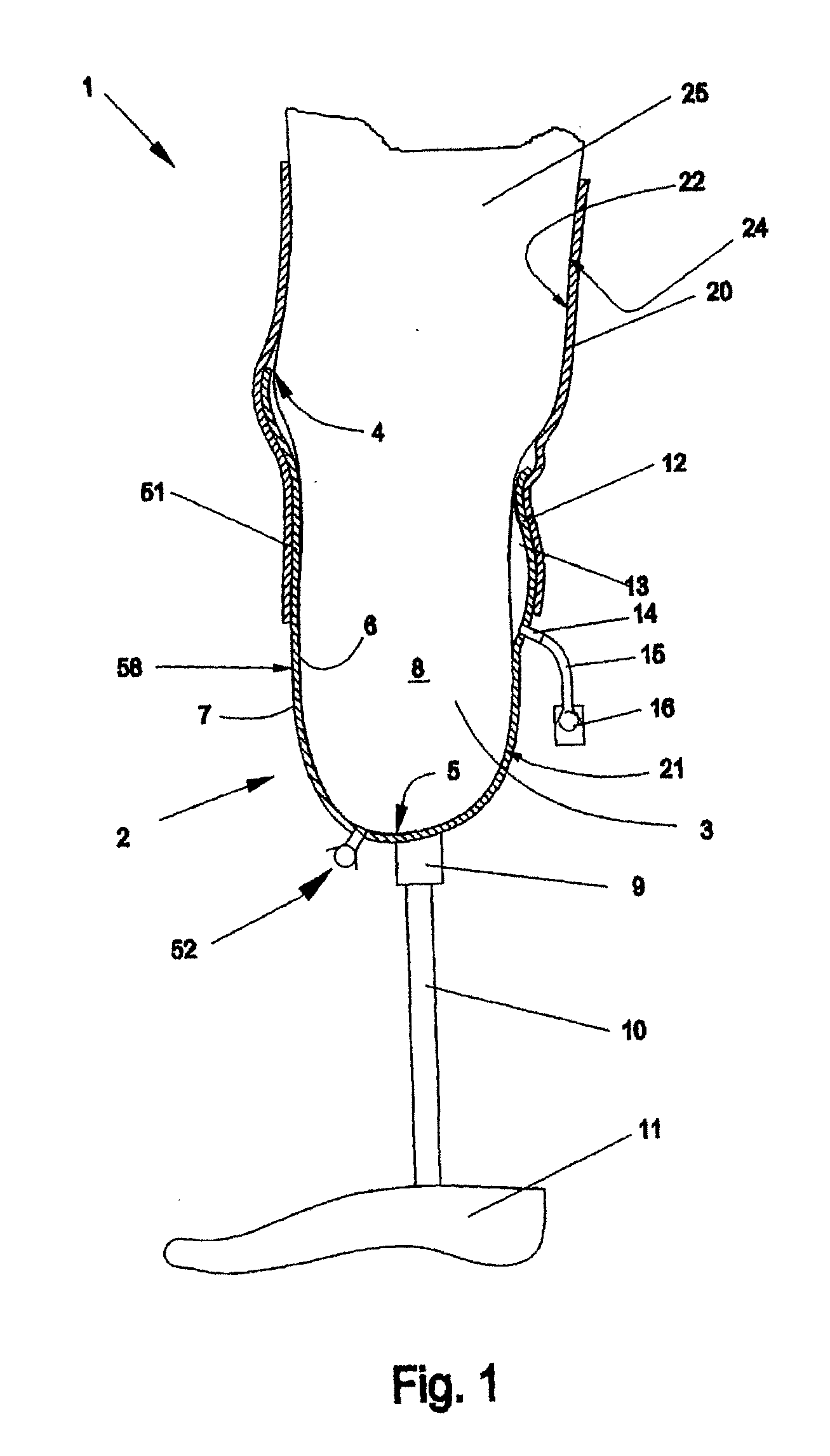 Prosthesis shaft with active air release