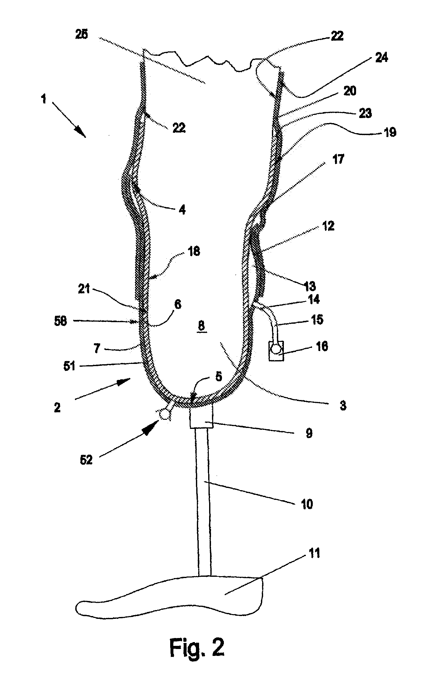 Prosthesis shaft with active air release