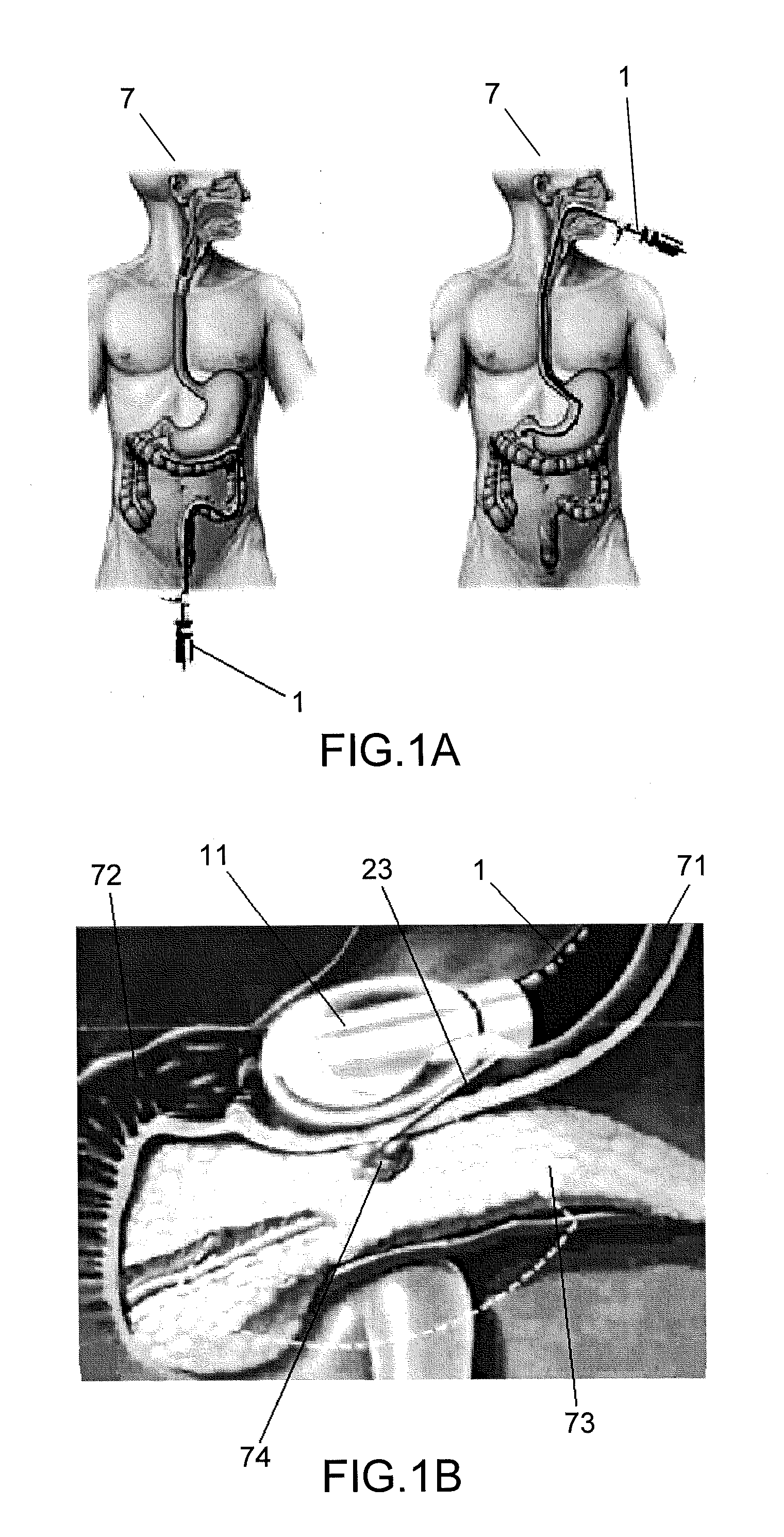 Method, an optical probe and a confocal microscopy system for inspecting a solid organ