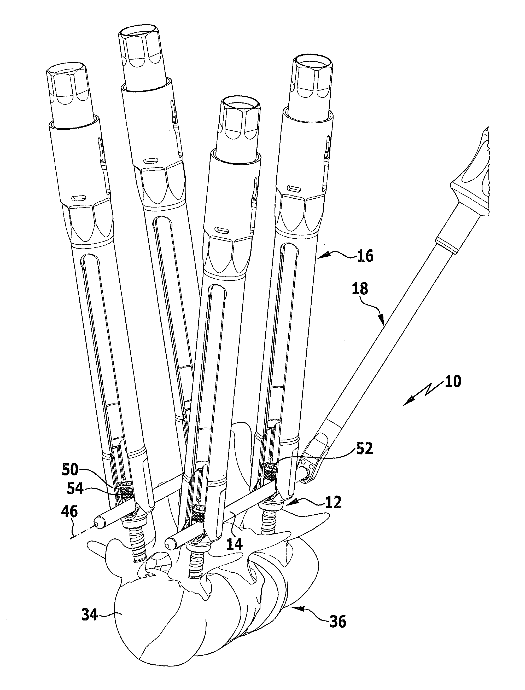 Medical instrument for holding and handling a surgical securing element, and vertebral column stabilization system