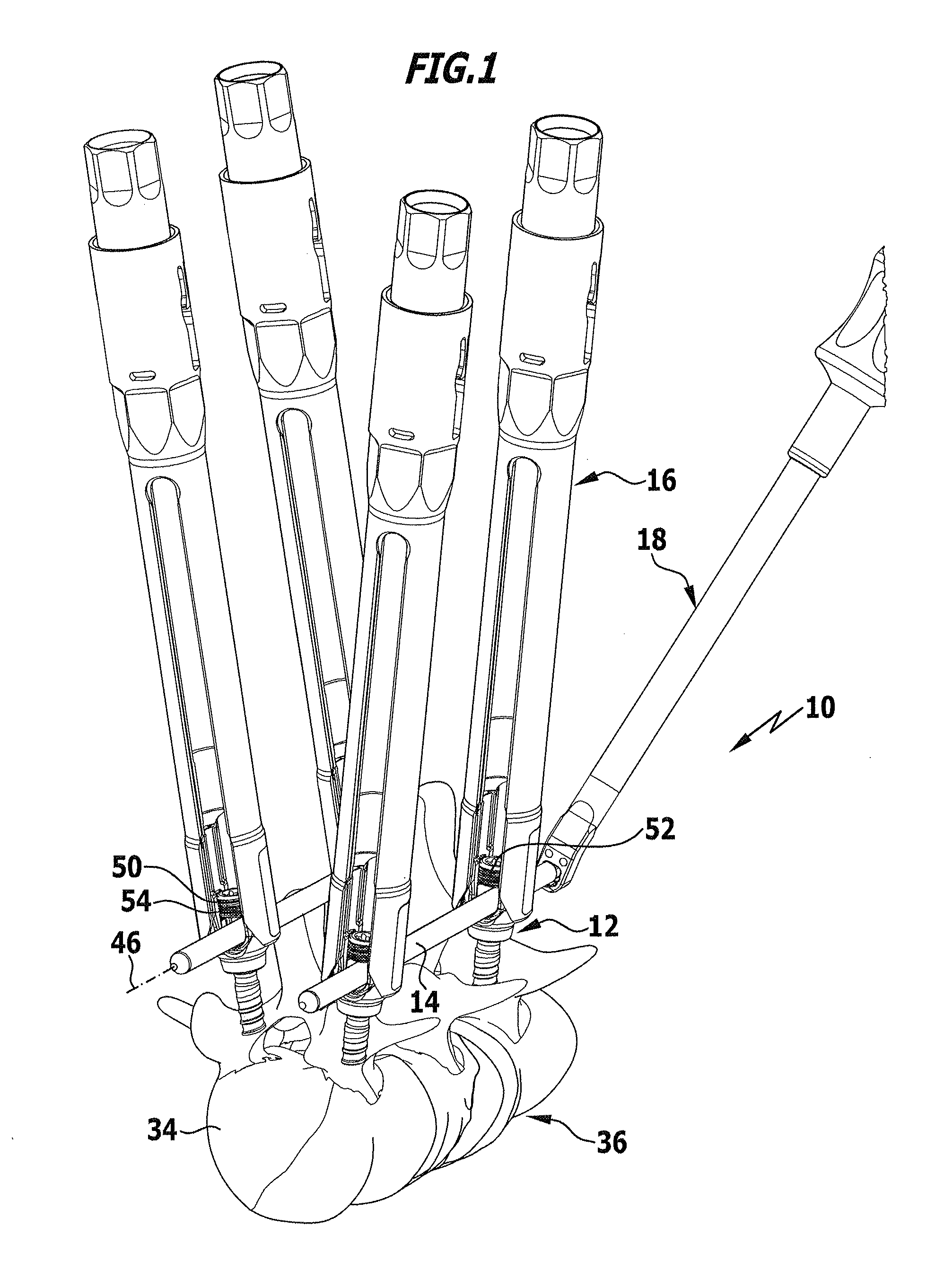 Medical instrument for holding and handling a surgical securing element, and vertebral column stabilization system