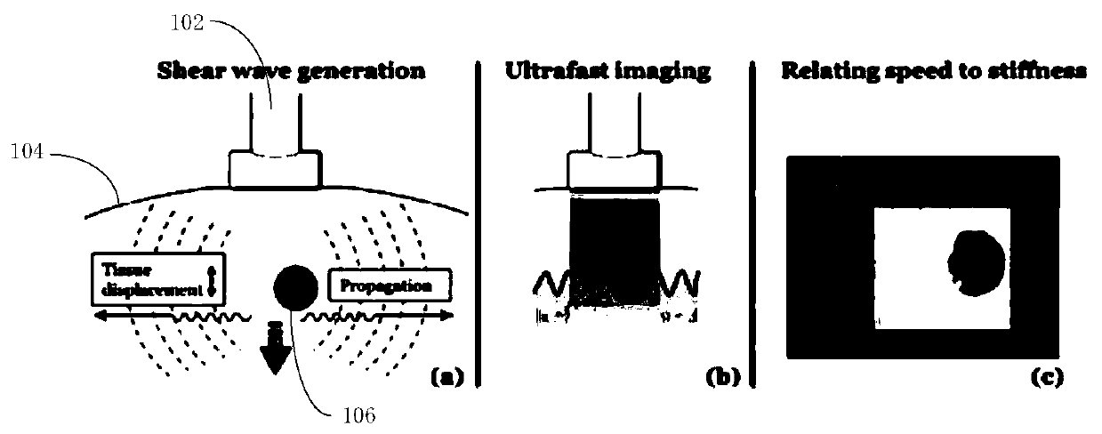 Elastography control method and device, computer equipment and readable storage medium